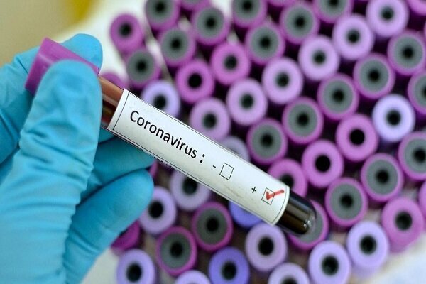 تولید واکسن کرونا در انگلیس با چالش روبرو شد