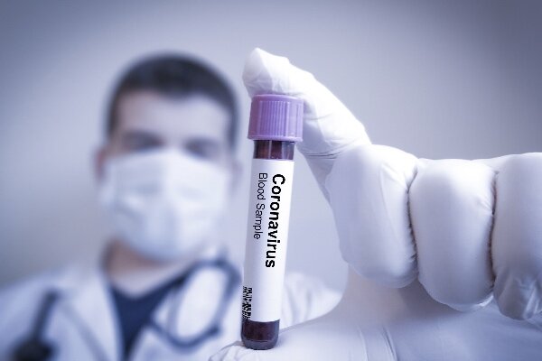 یک ویروس شناس عنوان کرد: عامل کشندگی ویروس کرونا/ شایع ترین علائم کووید ۱۹